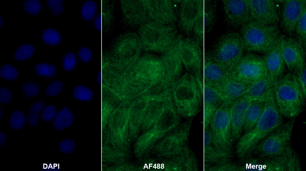 色氨酸-2,3-雙加氧酶(TDO)多克隆抗體