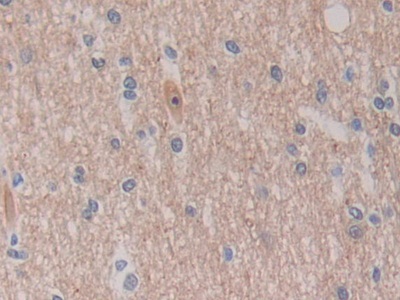 C-Ros癌基因1(ROS1)多克隆抗體