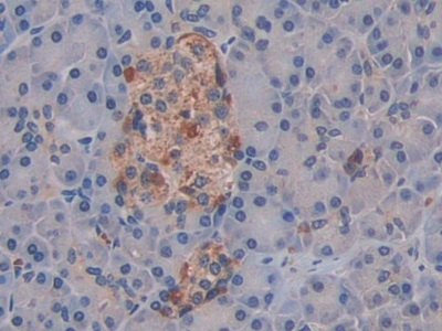 C-Ros癌基因1(ROS1)多克隆抗體
