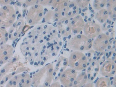 C-Ros癌基因1(ROS1)多克隆抗體