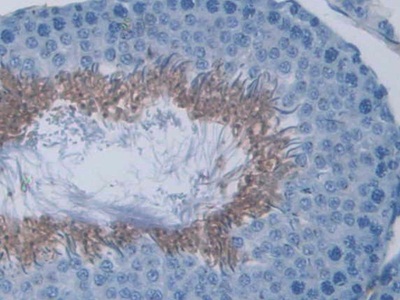 C-Ros癌基因1(ROS1)多克隆抗體