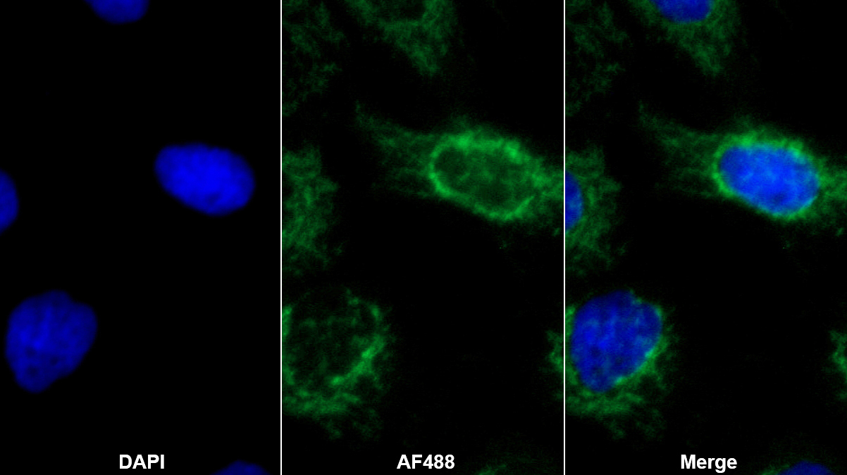 視神經(jīng)萎縮蛋白1(OPA1)多克隆抗體