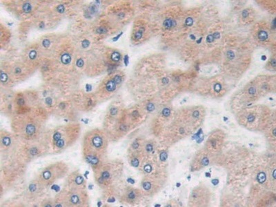 Ras同源基因家族成員Q(RHOQ)多克隆抗體