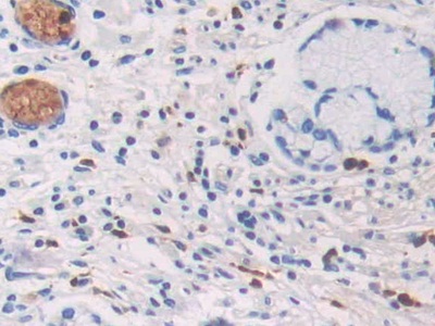 Ras同源基因家族成員Q(RHOQ)多克隆抗體