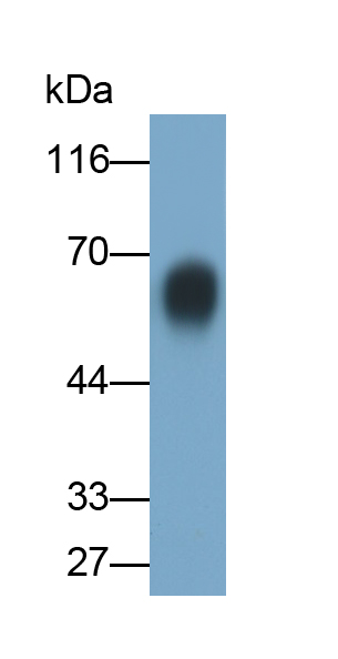 興奮性氨基酸轉(zhuǎn)運(yùn)蛋白1(EAAT1)多克隆抗體