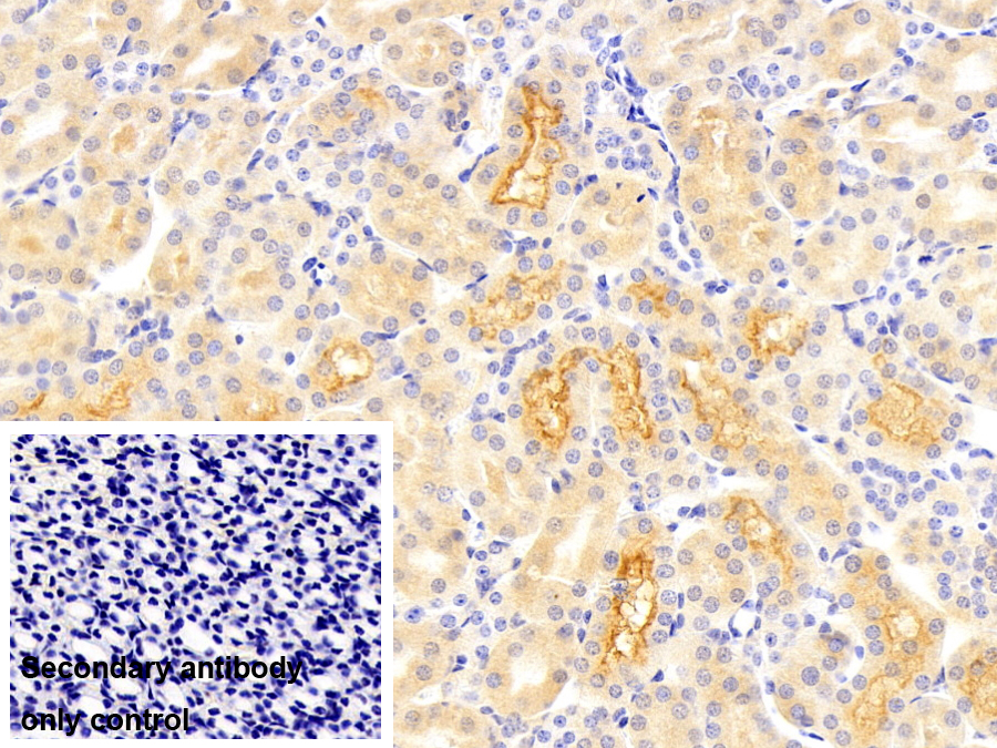 鈉/葡萄糖協(xié)同轉(zhuǎn)運(yùn)蛋白2(SGLT2)多克隆抗體