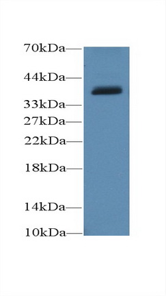 线粒体解偶联蛋白4(UCP4)多克隆抗体