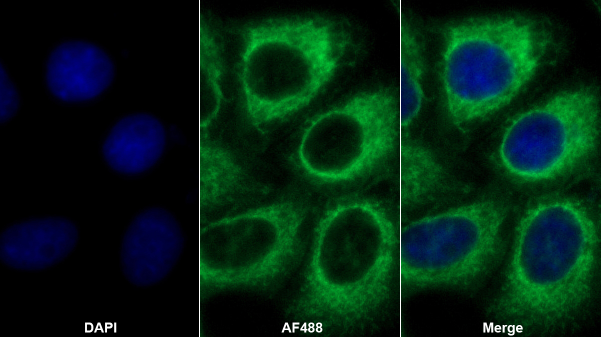 电子转移黄素蛋白α肽(ETFa)多克隆抗体