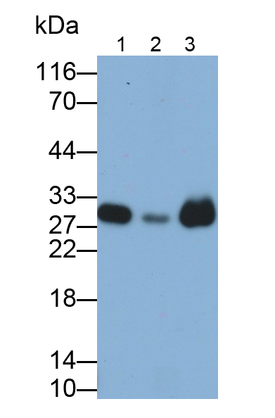 磷酸甘油酸變位酶1(PGAM1)多克隆抗體