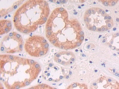 神经细胞黏附分子2(NCAM2)多克隆抗体