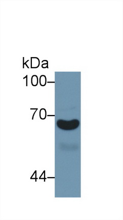 α1-B-糖蛋白(a1BG)多克隆抗體