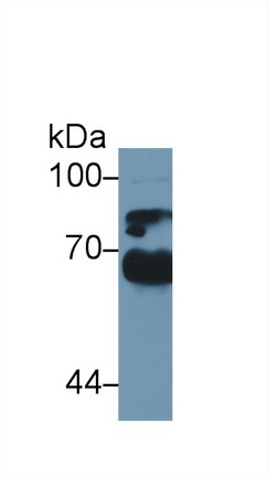 α1-B-糖蛋白(a1BG)多克隆抗體