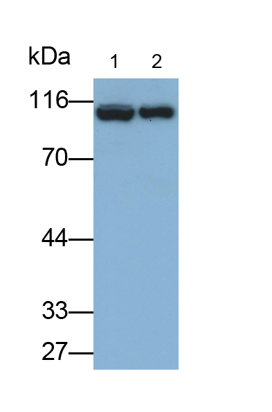 α1-B-糖蛋白(a1BG)多克隆抗體