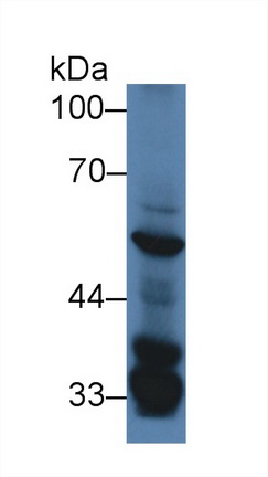 血清/糖皮质激素调节激酶3(SGK3)多克隆抗体