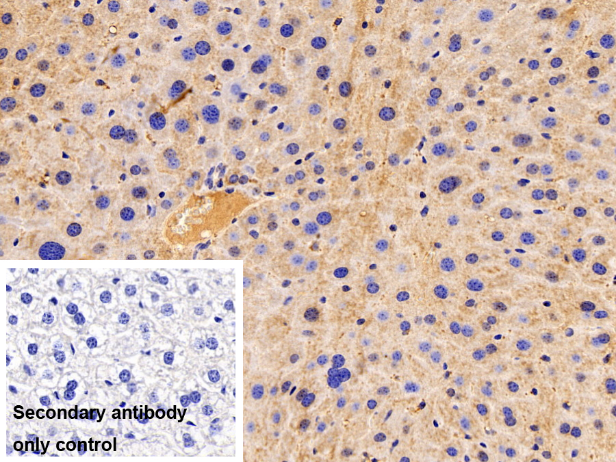 亨廷頓相互作用蛋白2(HIP2)多克隆抗體
