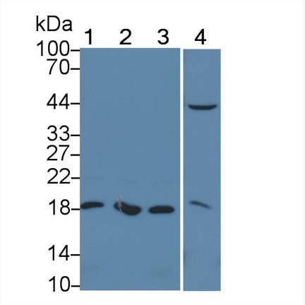 周期素依賴性激酶抑制因子1A(CDKN1A)多克隆抗體