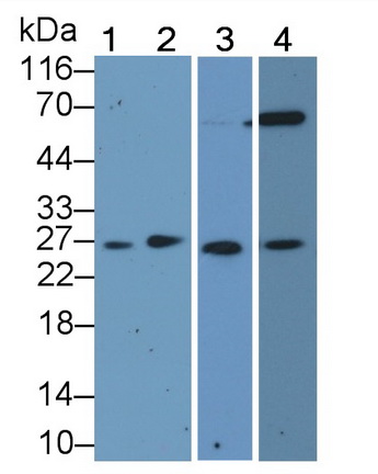 周期素依赖性激酶抑制因子1B(CDKN1B)多克隆抗体