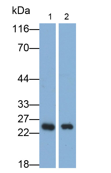 周期素依赖性激酶抑制因子1B(CDKN1B)多克隆抗体
