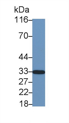周期素依赖性激酶抑制因子1B(CDKN1B)多克隆抗体