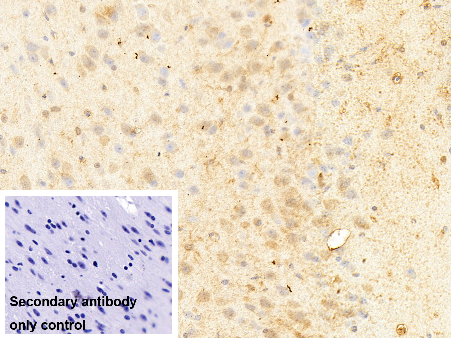 干扰素诱导鸟苷酸结合蛋白2(GBP2)多克隆抗体
