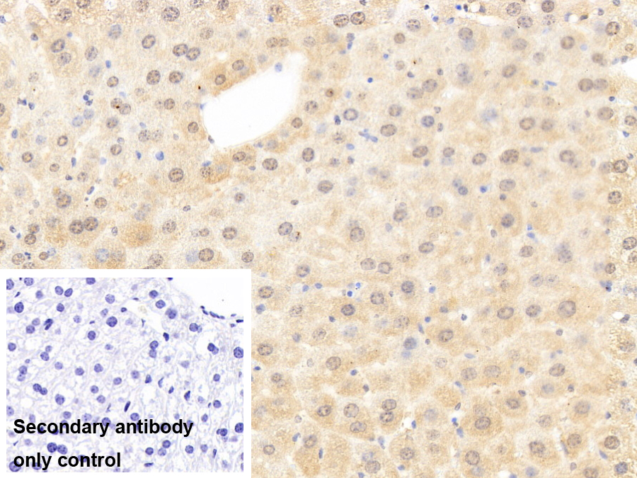 干扰素诱导鸟苷酸结合蛋白2(GBP2)多克隆抗体