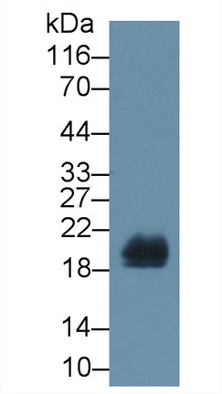 再生胰岛衍生蛋白1β(REG1b)多克隆抗体