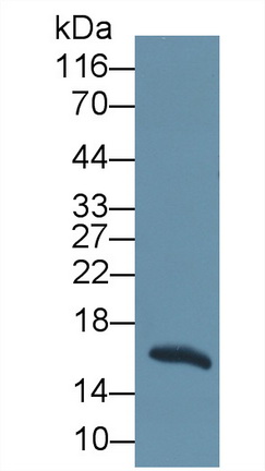 再生胰岛衍生蛋白1β(REG1b)多克隆抗体