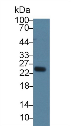 再生胰岛衍生蛋白3α(REG3a)多克隆抗体
