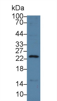 再生胰岛衍生蛋白3γ(REG3g)多克隆抗体