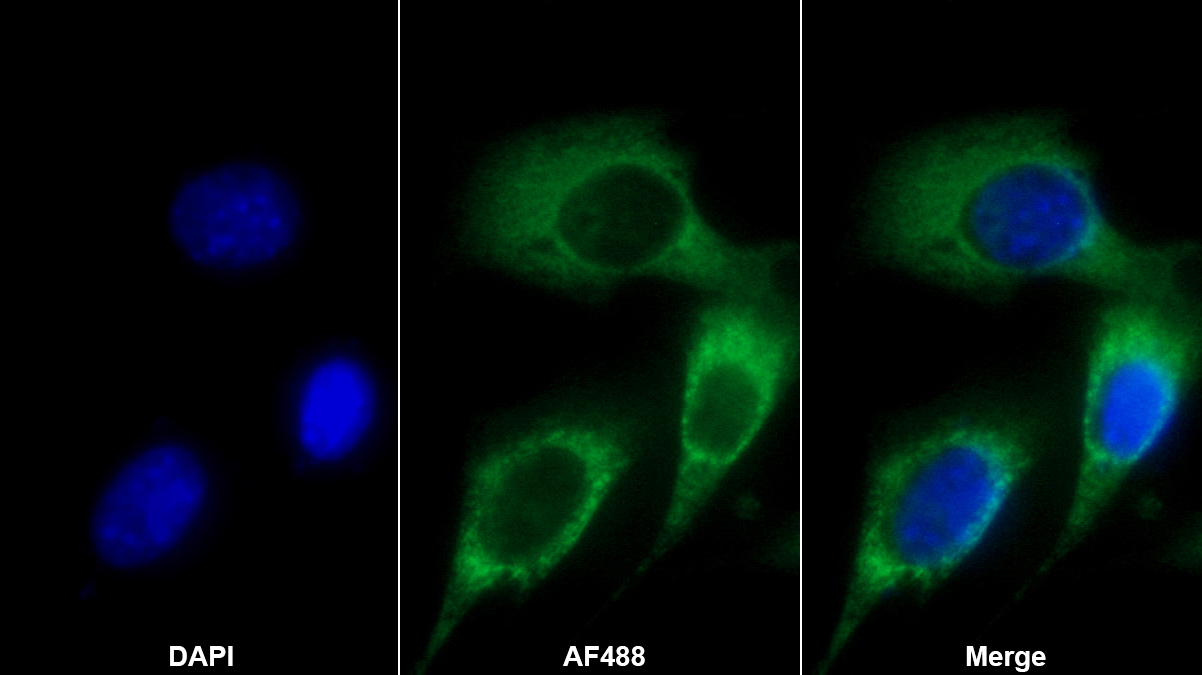 FK506結(jié)合蛋白10(FKBP10)多克隆抗體