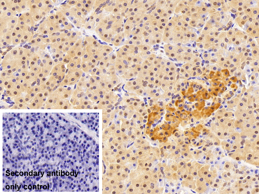 硒蛋白X1(SEPX1)多克隆抗體