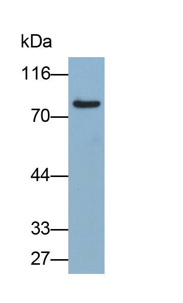 N-酰基鞘氨醇酰胺水解酶2(ASAH2)多克隆抗體