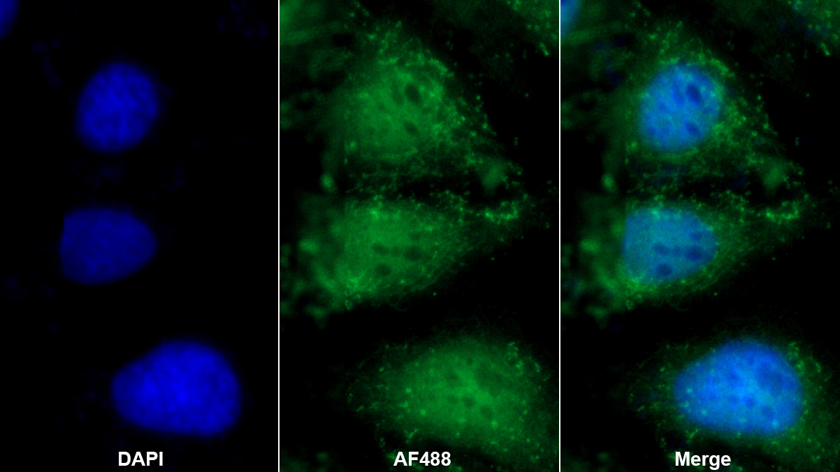 鞘氨醇激酶1(SPHK1)多克隆抗體