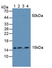 核因子κB抑制因子δ(IkBd)多克隆抗体