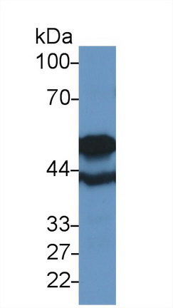 微管蛋白β6(TUBb6)多克隆抗体