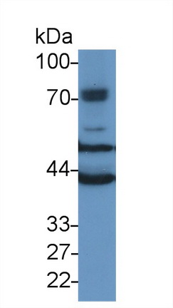 微管蛋白β6(TUBb6)多克隆抗体