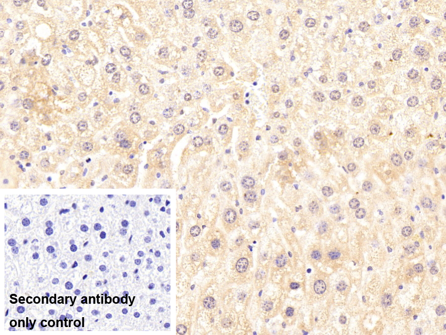 微管蛋白折疊輔酶B(TBCB)多克隆抗體