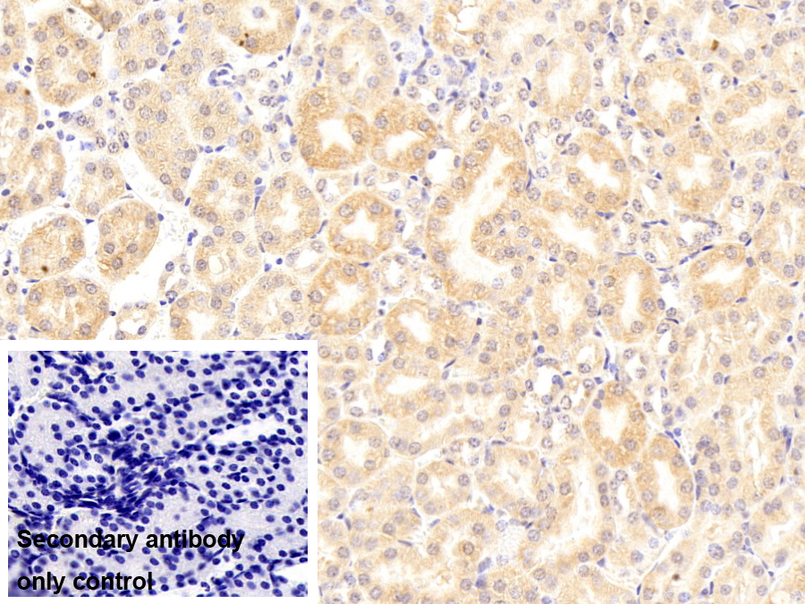 微管蛋白折疊輔酶B(TBCB)多克隆抗體