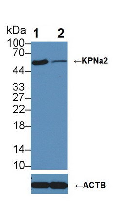 亲核素α2(KPNa2)多克隆抗体