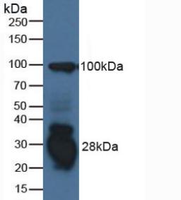 干扰素γ诱导蛋白30(IFI30)多克隆抗体