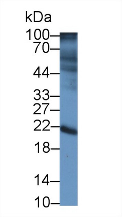 白介素22受体α2(IL22Ra2)多克隆抗体