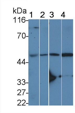 白介素11受体α(IL11Ra)多克隆抗体