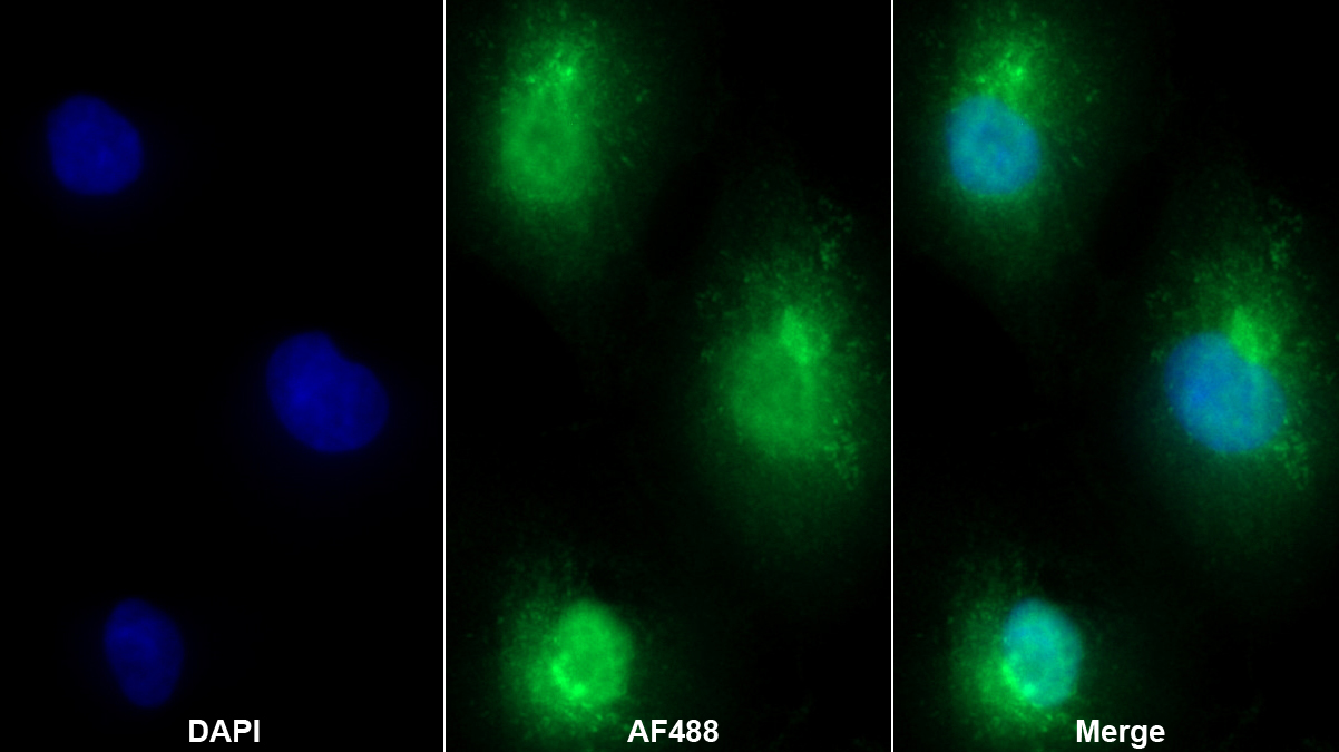 膜聯(lián)蛋白A4(ANXA4)多克隆抗體