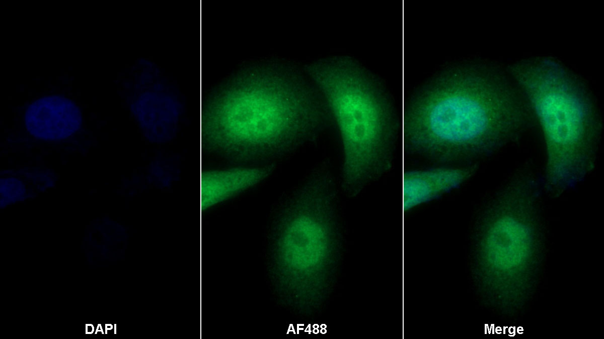 膜联蛋白A4(ANXA4)多克隆抗体