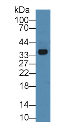 膜聯(lián)蛋白A3(ANXA3)多克隆抗體