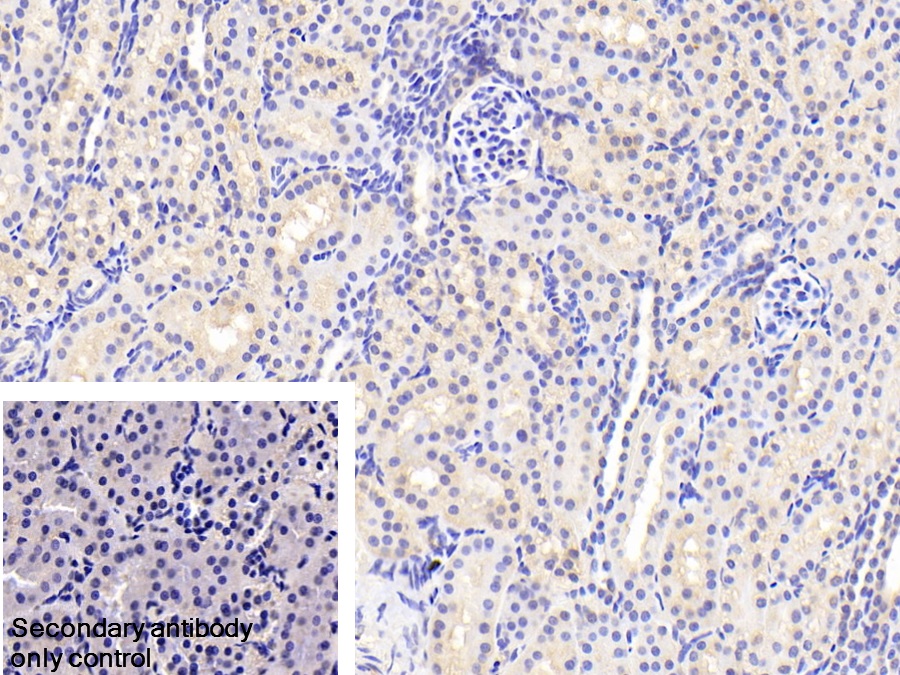 膜聯(lián)蛋白A3(ANXA3)多克隆抗體