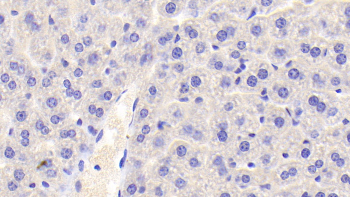 膜聯(lián)蛋白A3(ANXA3)多克隆抗體