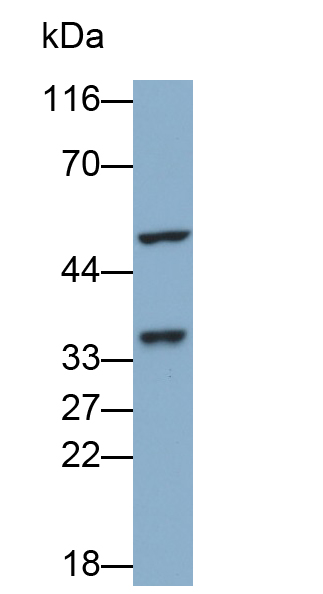 膜联蛋白A3(ANXA3)多克隆抗体