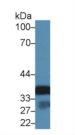 膜聯(lián)蛋白A3(ANXA3)多克隆抗體