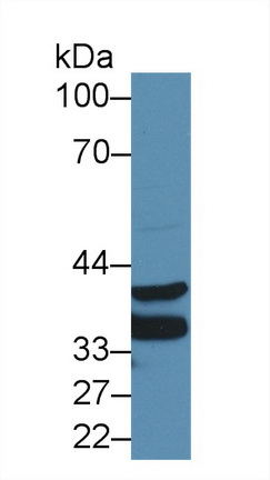 膜聯(lián)蛋白A3(ANXA3)多克隆抗體
